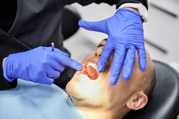 Best Emergency Tooth Extraction in Newcomerstown, OH