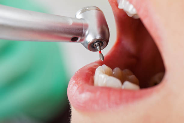Best Emergency Gum Treatment in Newcomerstown, OH